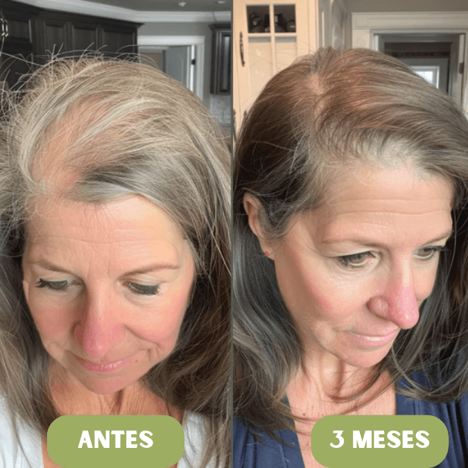 Aceite de crecimiento para el cabello Vitalis®