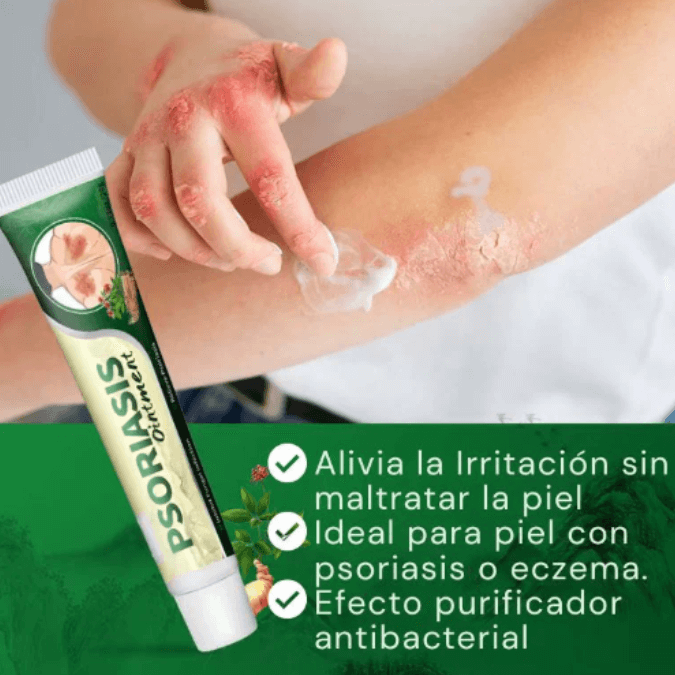 CalmiSkin™ Crema Para Aliviar Picazón de Psoriasis