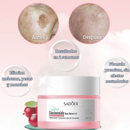 Crema Sadoer® - Despídete del melasma, pecas y manchas de la edad