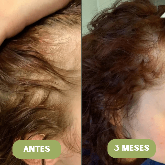 Aceite de crecimiento para el cabello Vitalis®