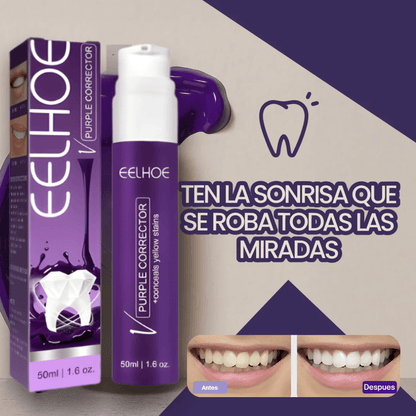 EELHOE™ – El Secreto para un blanqueo dental en solo minutos